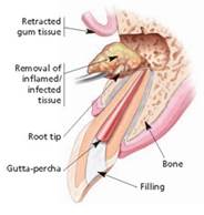 Endodontic Specialist of Oakhurst